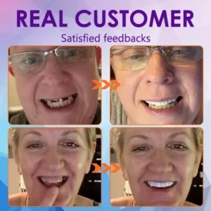 YUNPSO™ Advanced Customized Full Denture Set
