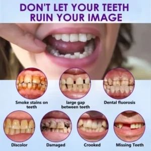 YUNPSO™ Advanced Customized Full Denture Set