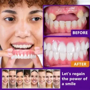 YUNPSO™ Advanced Customized Full Denture Set