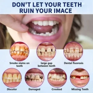 YUNPSO™ Advanced Customized Full Denture Set