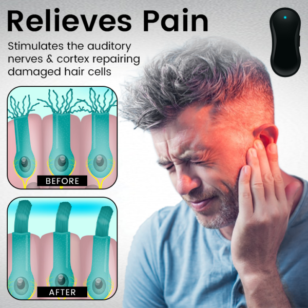 YUNPSO™ Tinnitus Relief Device Serenity