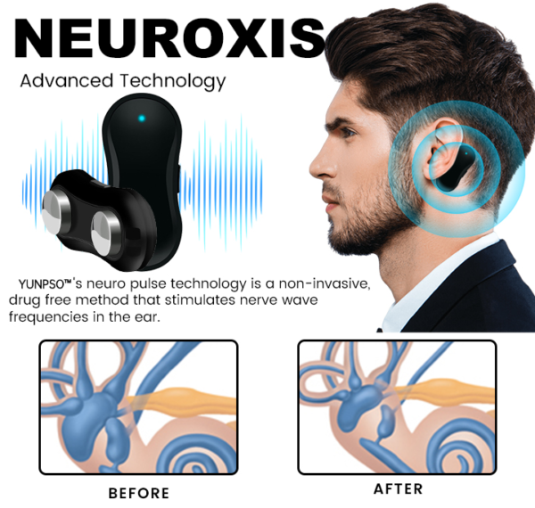YUNPSO™ Tinnitus Relief Device Serenity
