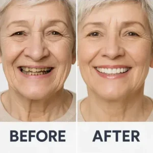 YUNPSO™ 3D Dentures