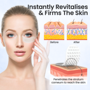 YUNPSO™ Hyaluronic acid microneedle patch