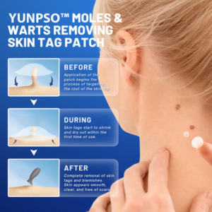 YUNPSO™ Moles & Warts Removing Skin Tag Patch