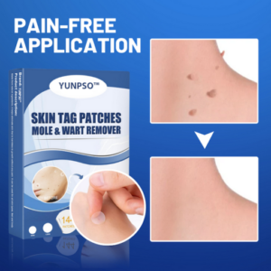 YUNPSO™ Moles & Warts Removing Skin Tag Patch