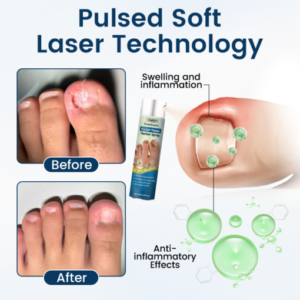 YUNPSO™ OnyxiGuard Fungal Repair Herbal Spray