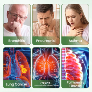 YUNPSO™ SylvanLung Herbal Detox Inhaler