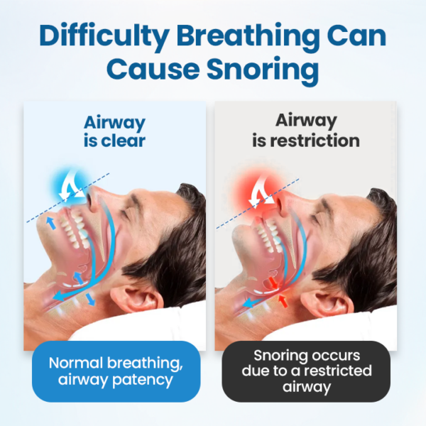 YUNPSO™ SnoreLess Nasal Breather