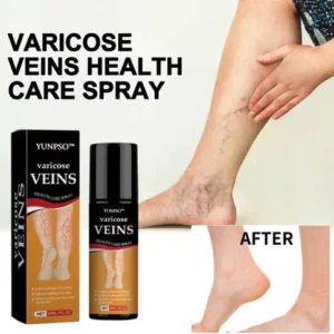 YUNPSO Turmeric Varicose Veins Relief Spray