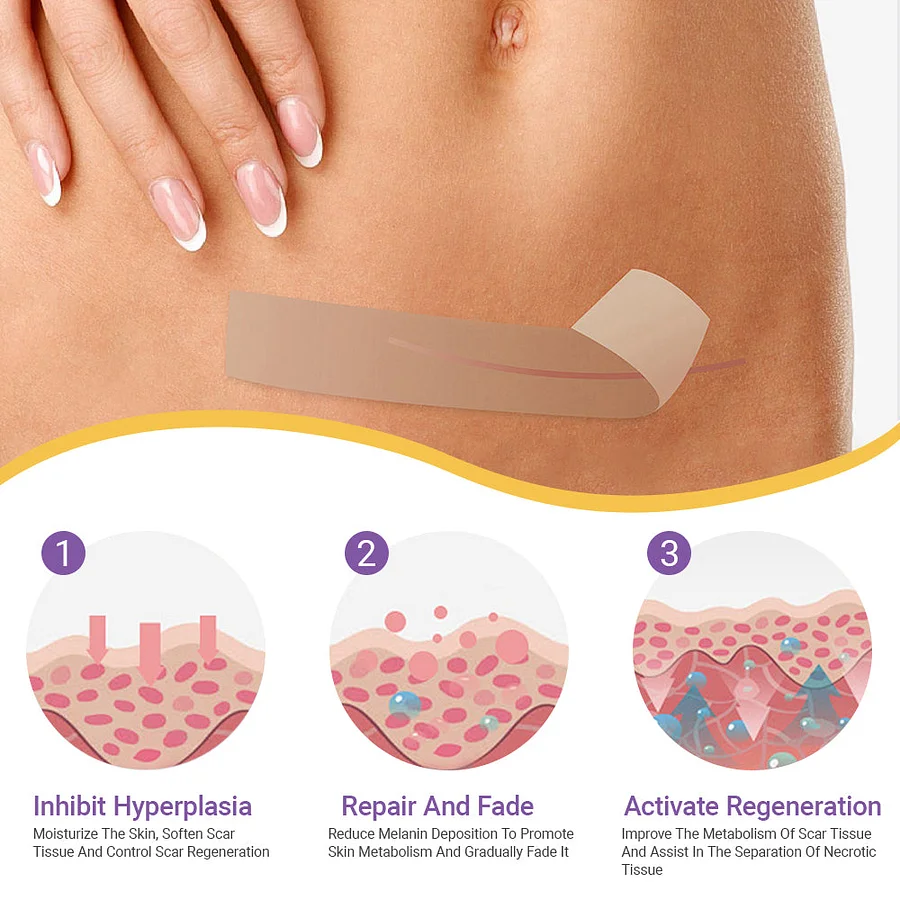 YUNPSO™ Hyaluronic Acid Nano Microneedle Repair Tape - Image 3