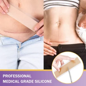 Alternative view of YUNPSO™ Hyaluronic Acid Nano Microneedle Repair Tape