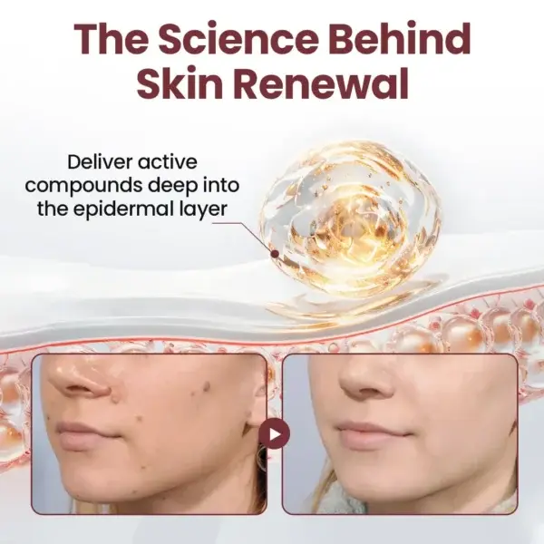 Biancat® KeraErase Dual-Action Renewal Cream