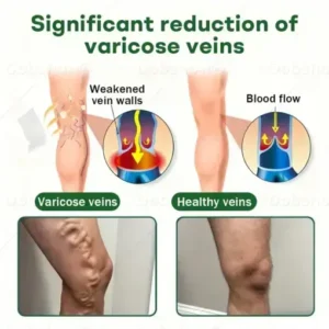 Croaie® VeinLock Microneedle Patch