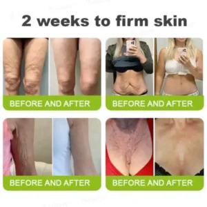 Rolimey® Botox & Vita-A Retinol Shot Wrinkle-Lift Tightening Cream