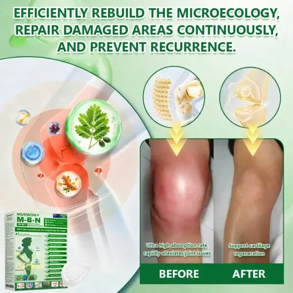 ๐ด๐ผ๐น๐พ๐ถ๐ตยฎ ๐๐ฒ๐ฟ๐ฏ๐ฒ๐ฟ๐ถ๐ป๐ฒ ๐๐-๐ข๐ง-๐ ๐ก๐ฎ๐ป๐ผ ๐ ๐ถ๐ฐ๐ฟ๐ผ๐ป๐ฒ๐ฒ๐ฑ๐น๐ฒ ๐ฃ๐ฎ๐๐ฐ๐ต