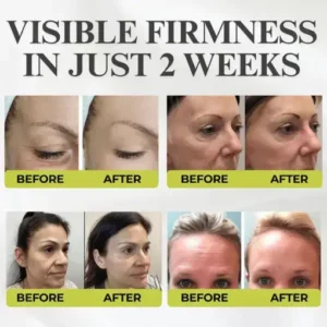 Yunpso® Botox & Vita-A Retinol Shot Wrinkle-Lift Tightening cream