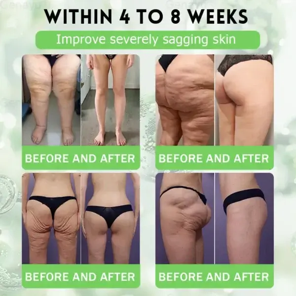 Genayu®️ MORINGA+BERBERINE Advenaced Nano Microneedle Patch