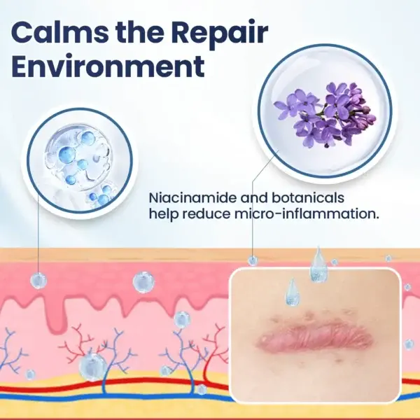 Nexisify® DERMALUX Texture Repair Gel