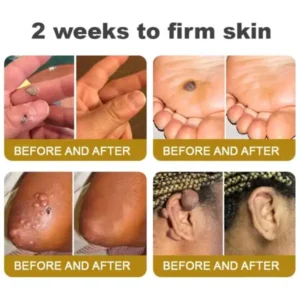 Rolimey® Botox Bee Venom Skin Treatment Cream