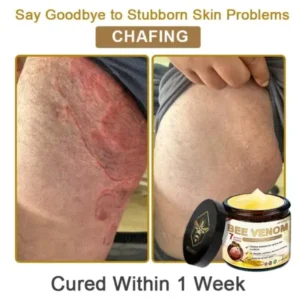 Rolimey® Botox Bee Venom Skin Treatment Cream