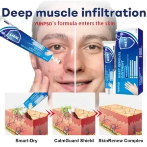 YUNPSO® Mole and Wart Removal Cream
