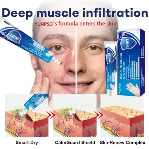 YUNPSO® Mole and Wart Removal Cream