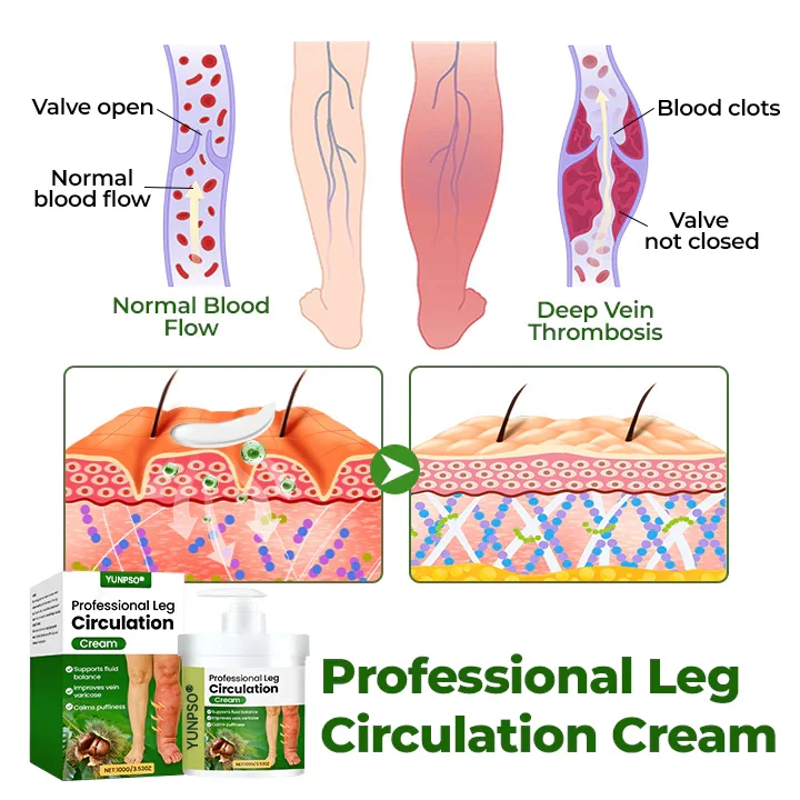 Yunpso® Professional Leg Circulation Cream - Image 5
