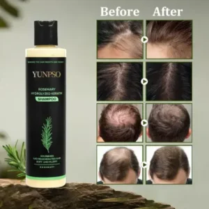 YUNPSO Organic Rosemary Hair Growth Shampoo Hair Conditioner