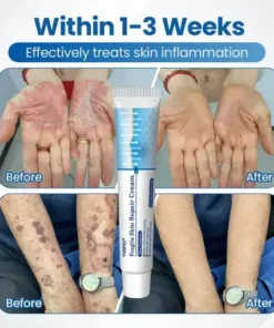 YUNPSO® Fragile Skin Repair Cream