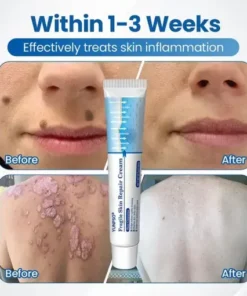 YUNPSO® Fragile Skin Repair Cream