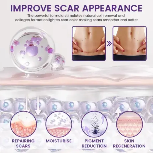 Yunpso® Viregensa Stem Cell Scar Gel