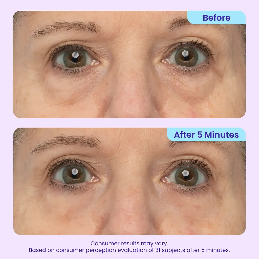 Yunpso™ Instant Lift Eye Gel - Image 5