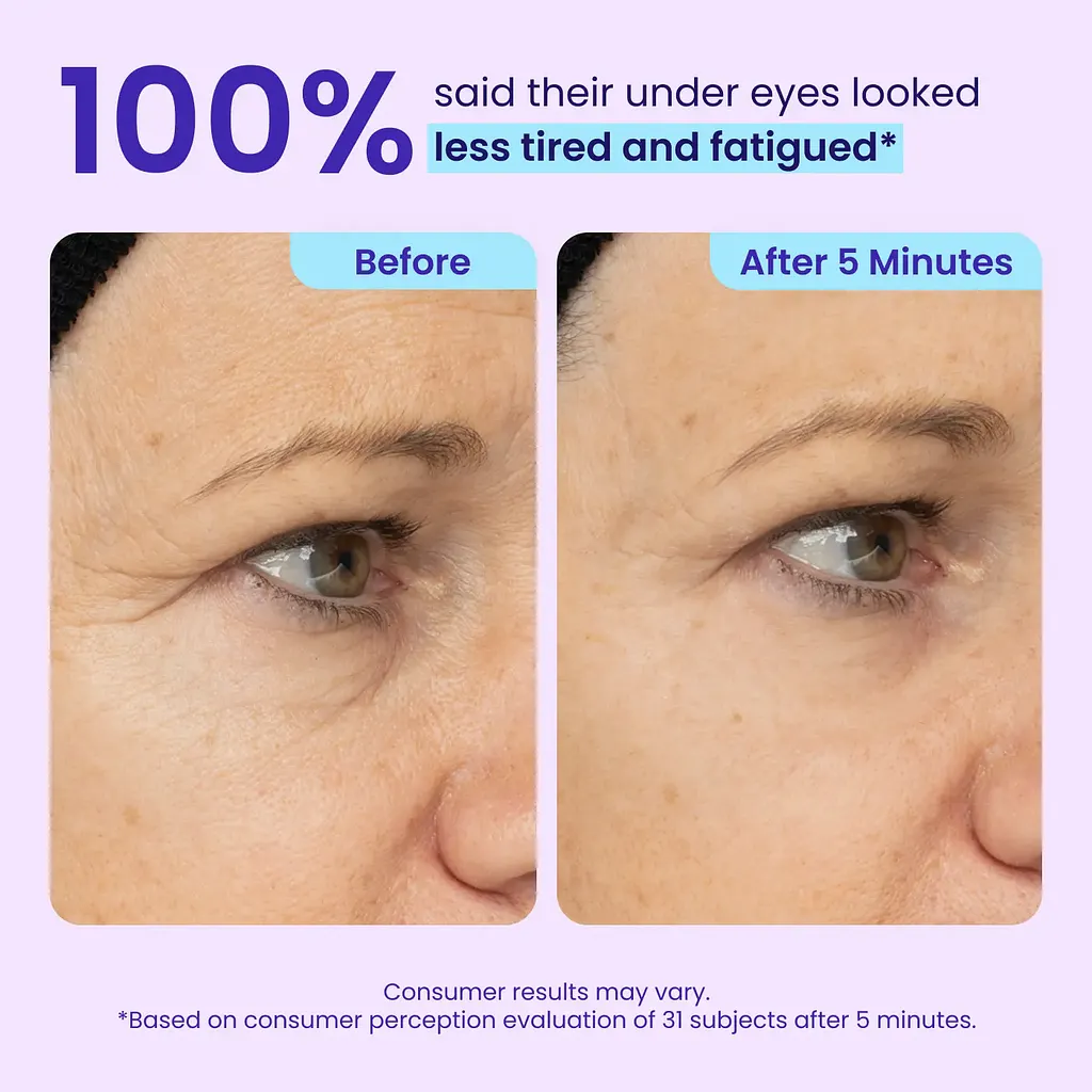 Yunpso™ Instant Lift Eye Gel - Image 4