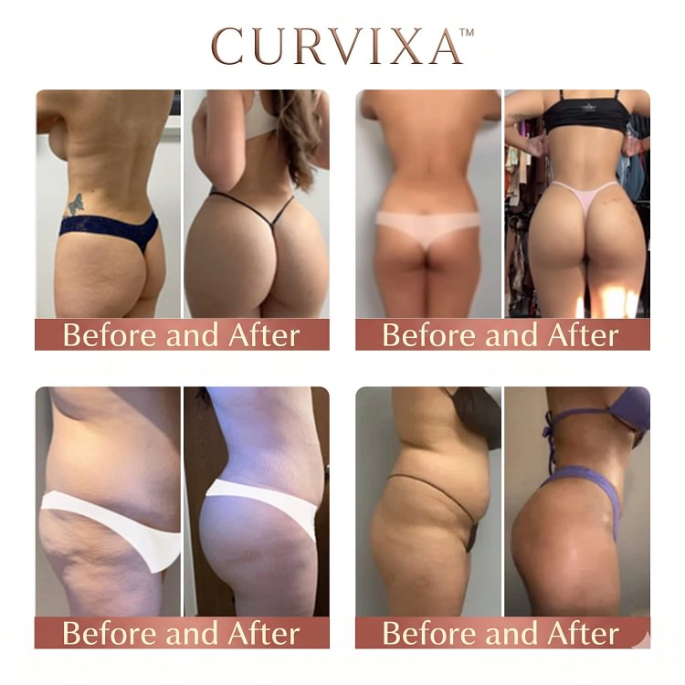 Yunpso® CurveSculpt Micro-Patch - Image 4